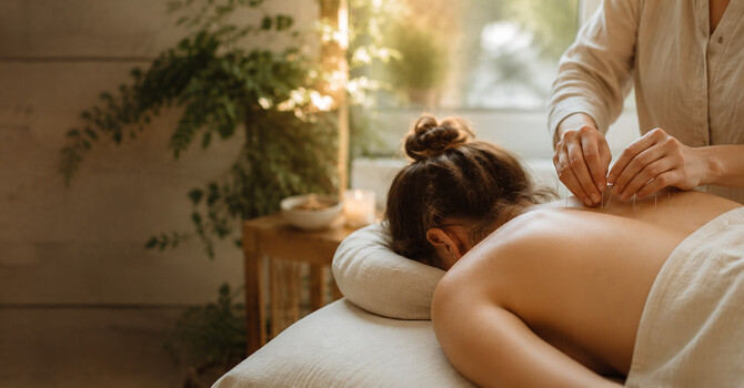 Acupuncture